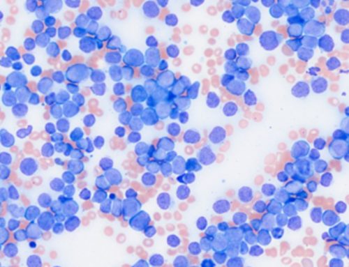 Review of Panoptiq™ Publication on Peripheral Blood Film Abnormalities