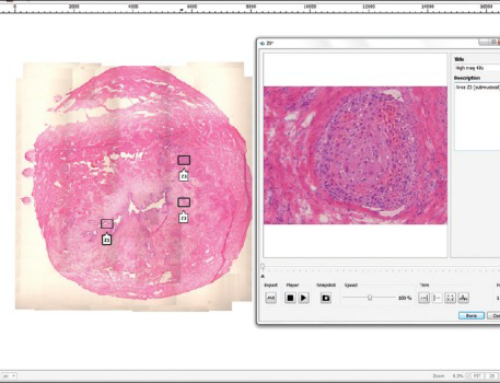 Comparing Panoptiq™ software to competitive WSI