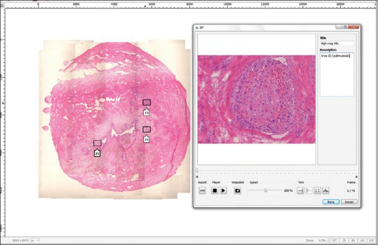 The Panoptiq camera captures Z-stack videos at 15 frames per second and regions of interest were captured at 40X magnification by focusing up and down using the microscope’s fine focus knob.